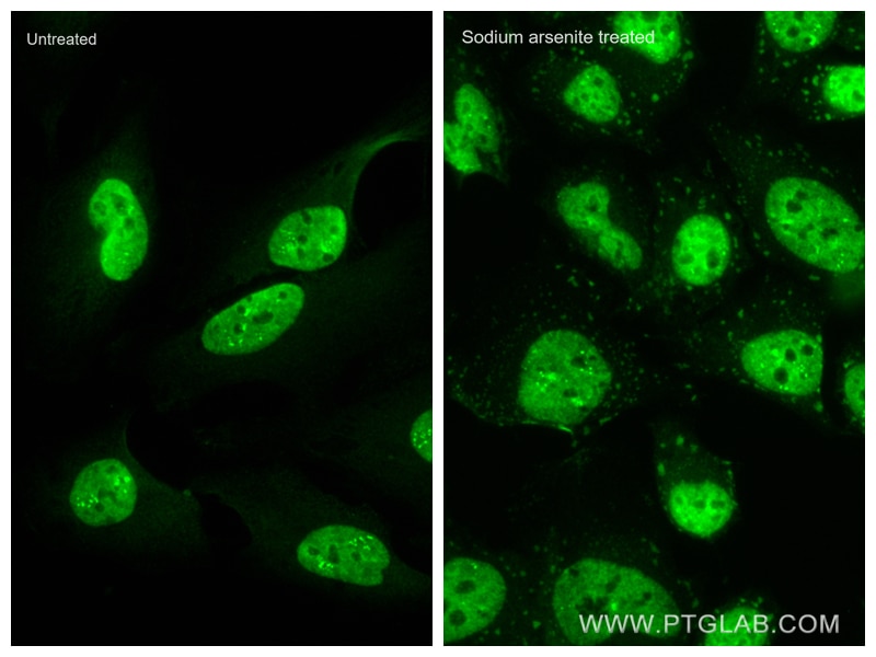 Immunofluorescence (IF) / fluorescent staining of HeLa cells using CoraLite® Plus 488-conjugated TIA1 Recombinant ant (CL488-82672)