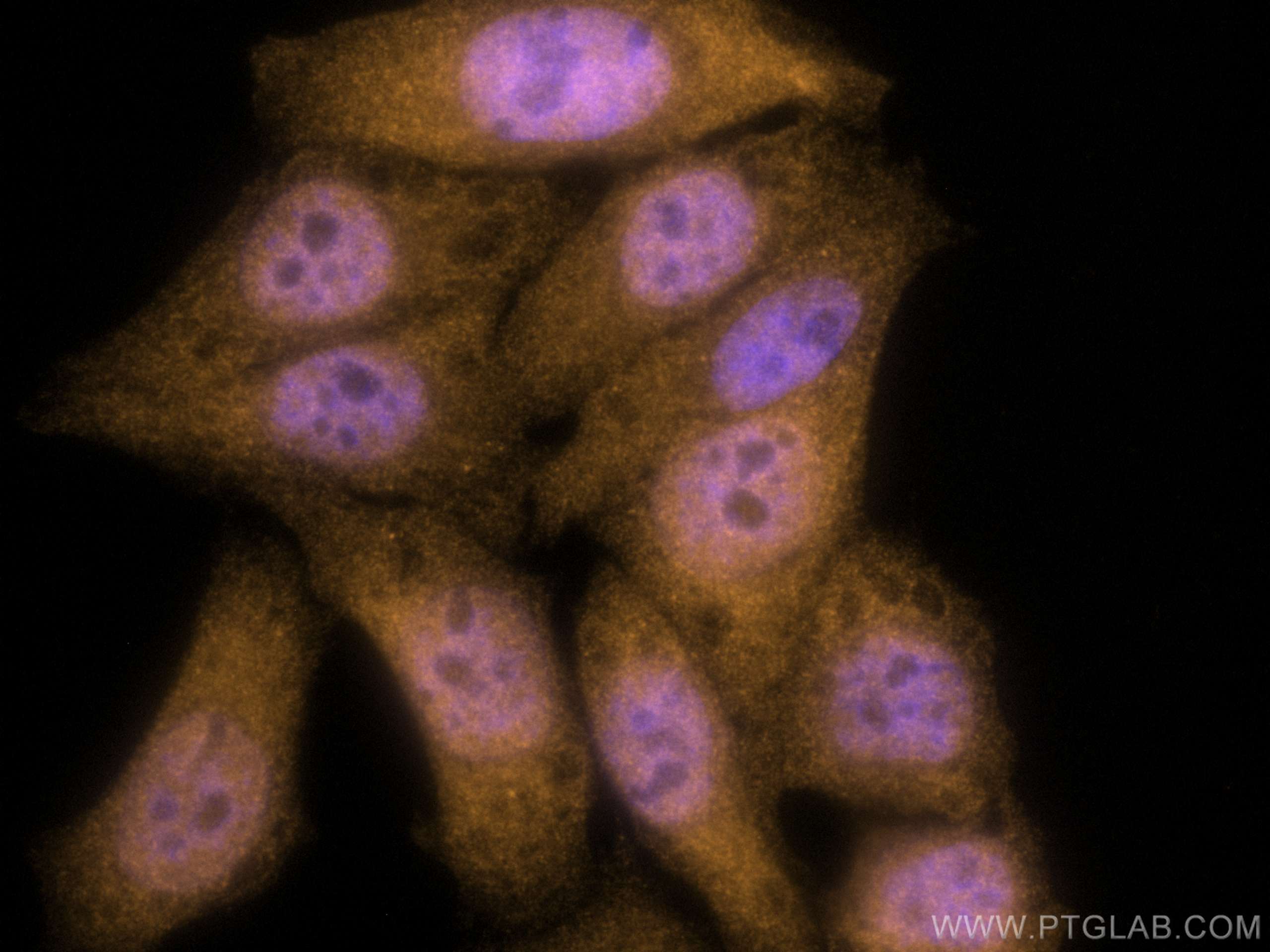 Immunofluorescence (IF) / fluorescent staining of HepG2 cells using CoraLite®555-conjugated TIA1 Polyclonal antibody (CL555-12133)