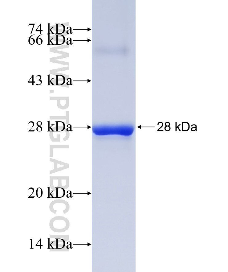 TIA1 fusion protein Ag25304 SDS-PAGE