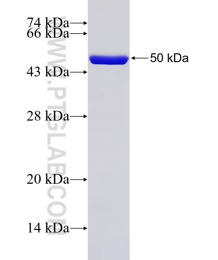 TIA1 fusion protein Ag2778 SDS-PAGE