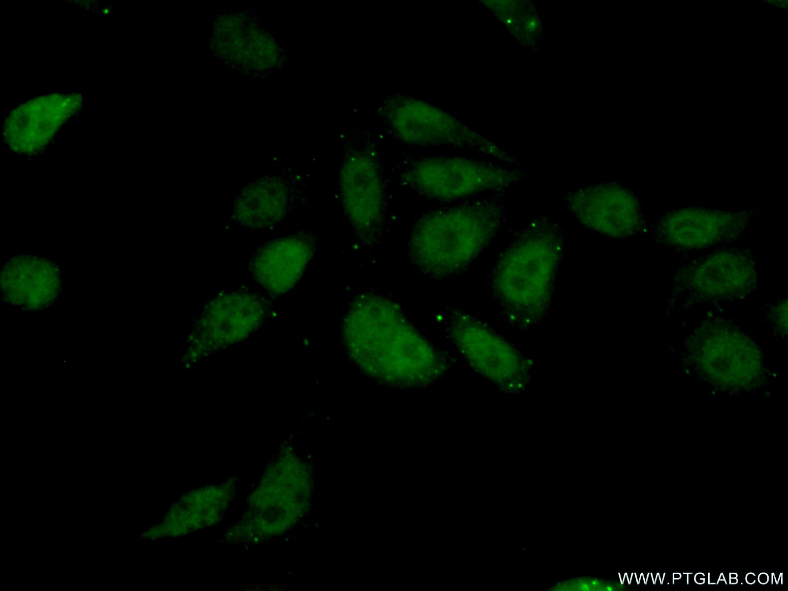 Immunofluorescence (IF) / fluorescent staining of PC-3 cells using TIAF1 Polyclonal antibody (20328-1-AP)