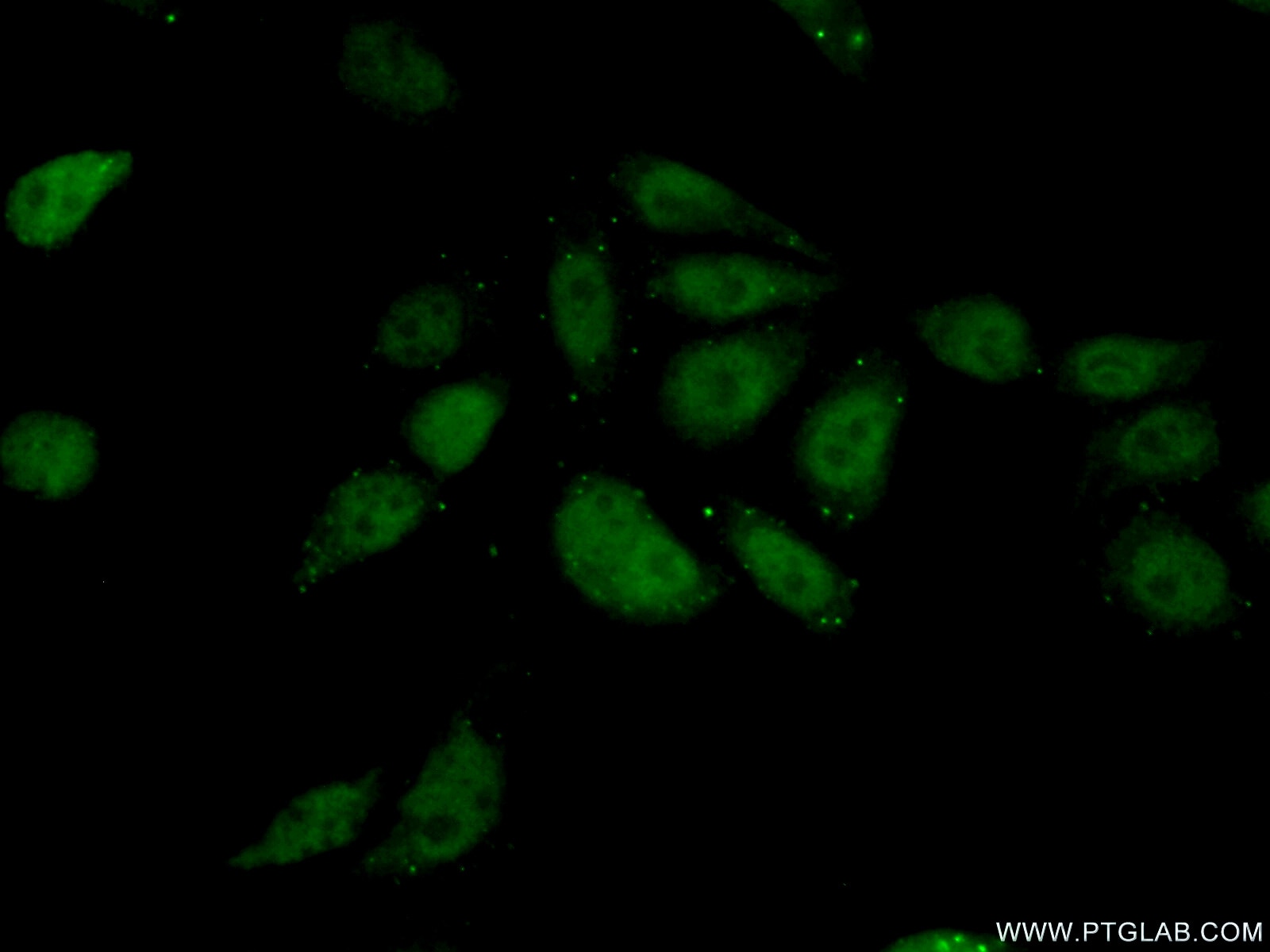 IF Staining of PC-3 using 20328-1-AP