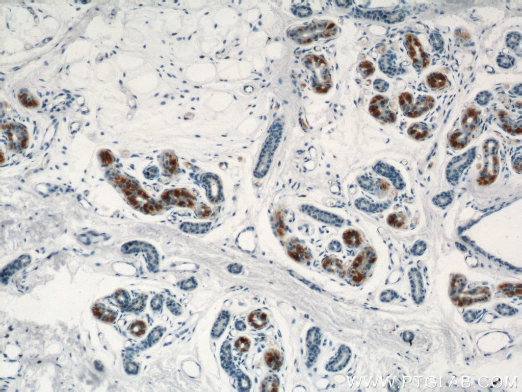Immunohistochemistry (IHC) staining of human skin tissue using TIAF1 Polyclonal antibody (20328-1-AP)