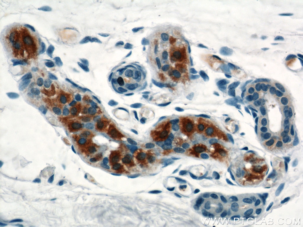 Immunohistochemistry (IHC) staining of human skin tissue using TIAF1 Polyclonal antibody (20328-1-AP)