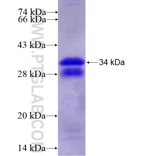 TIAR fusion protein Ag11981 SDS-PAGE