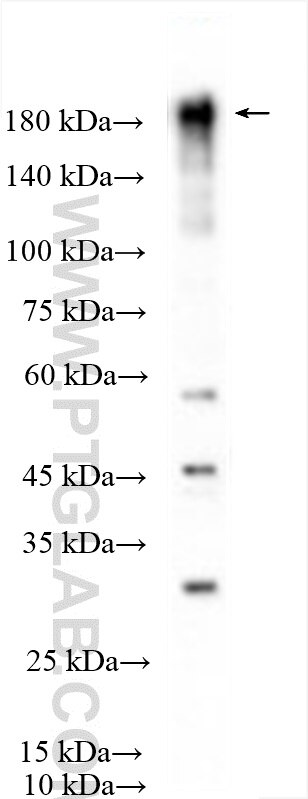 Western Blot (WB) analysis of HCT 116 cells using TIAM1 Polyclonal antibody (27694-1-AP)