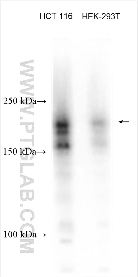 Western Blot (WB) analysis of various lysates using TIAM1 Polyclonal antibody (27694-1-AP)