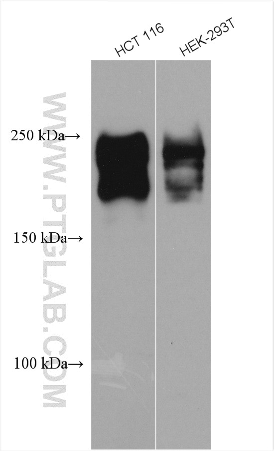 Western Blot (WB) analysis of various lysates using TIAM1 Polyclonal antibody (27694-1-AP)