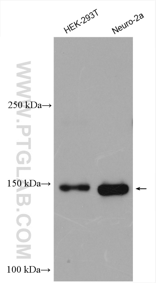 Western Blot (WB) analysis of various lysates using TIAM1 Polyclonal antibody (27694-1-AP)