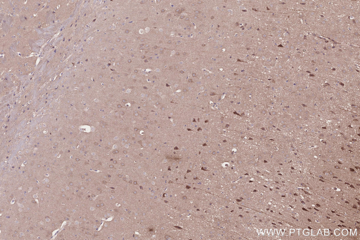 Immunohistochemistry (IHC) staining of mouse brain tissue using TIAM2 Polyclonal antibody (26870-1-AP)