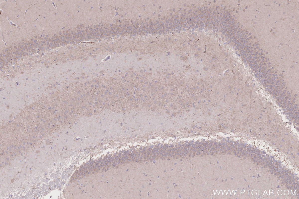 Immunohistochemistry (IHC) staining of rat brain tissue using TIAM2 Polyclonal antibody (26870-1-AP)