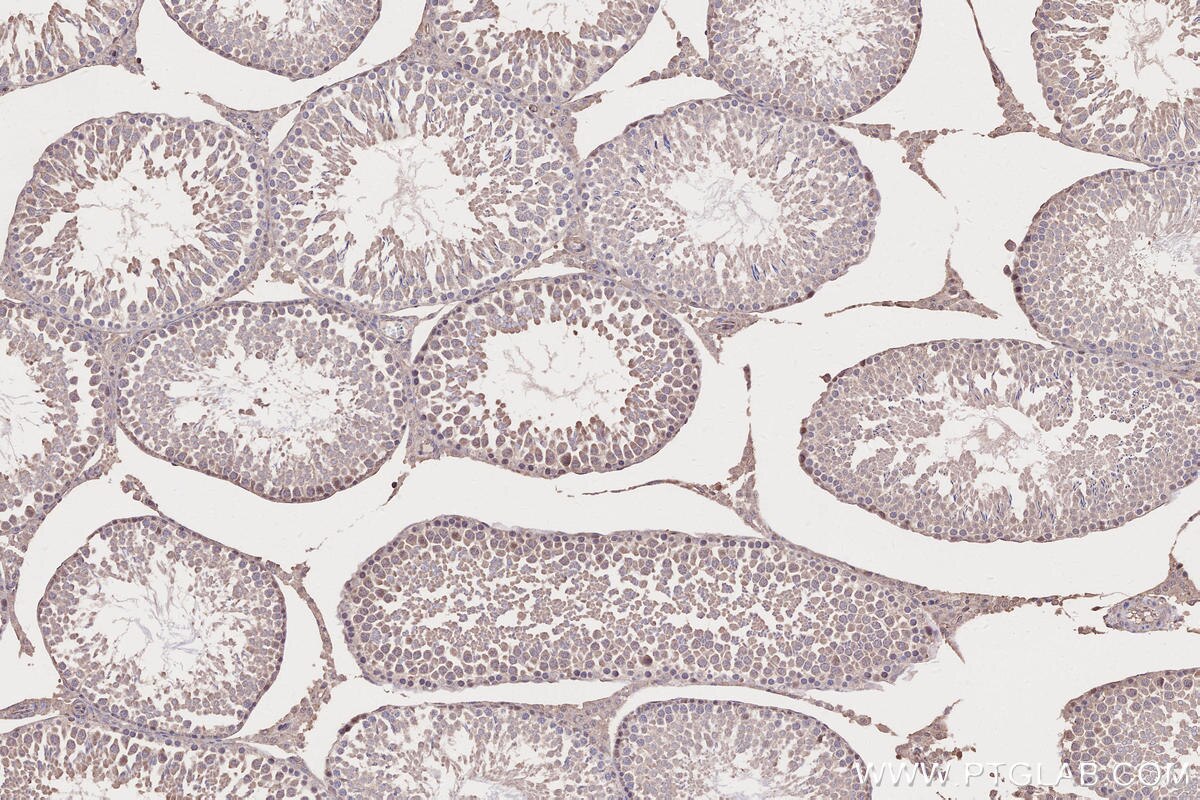 Immunohistochemistry (IHC) staining of rat testis tissue using TIAM2 Polyclonal antibody (26870-1-AP)