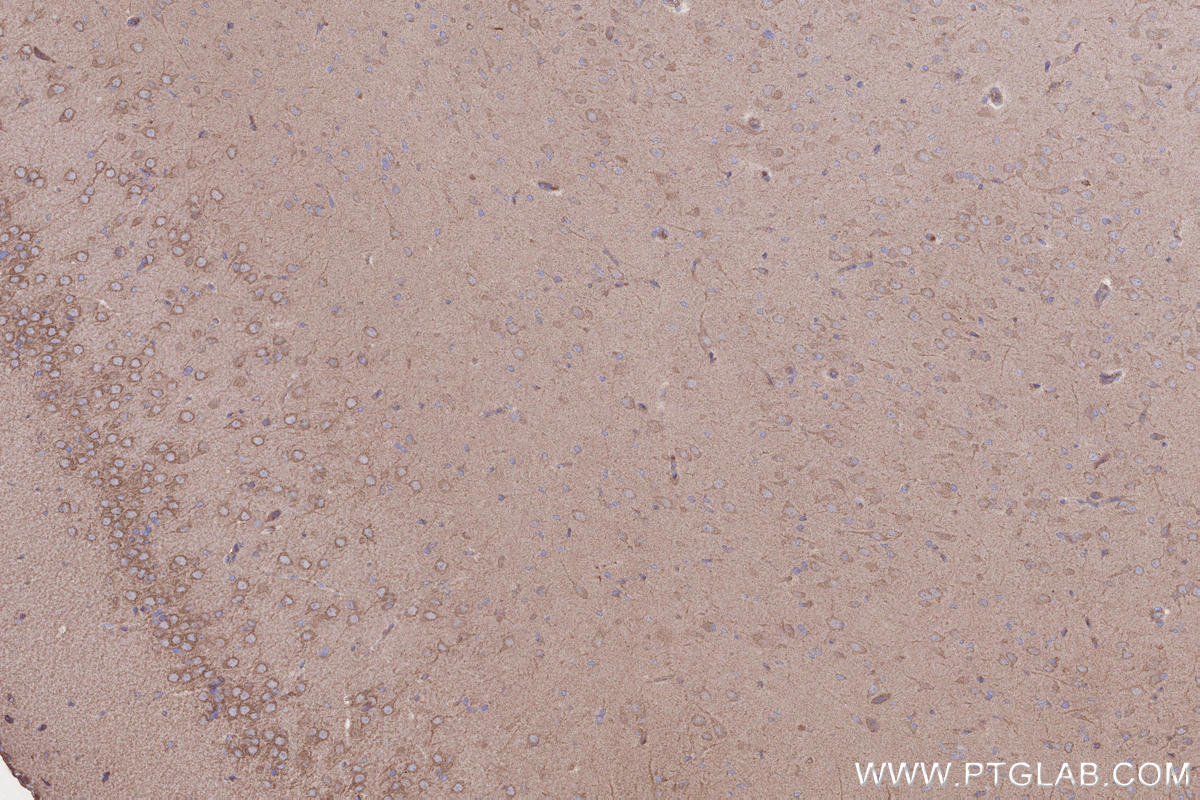 Immunohistochemistry (IHC) staining of rat brain tissue using TIAM2 Polyclonal antibody (26870-1-AP)