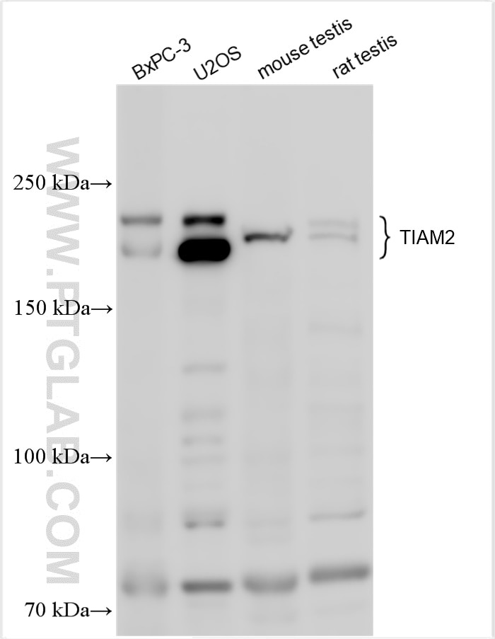 Western Blot (WB) analysis of various lysates using TIAM2 Polyclonal antibody (26870-1-AP)