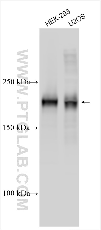 Western Blot (WB) analysis of various lysates using TIAM2 Polyclonal antibody (26870-1-AP)