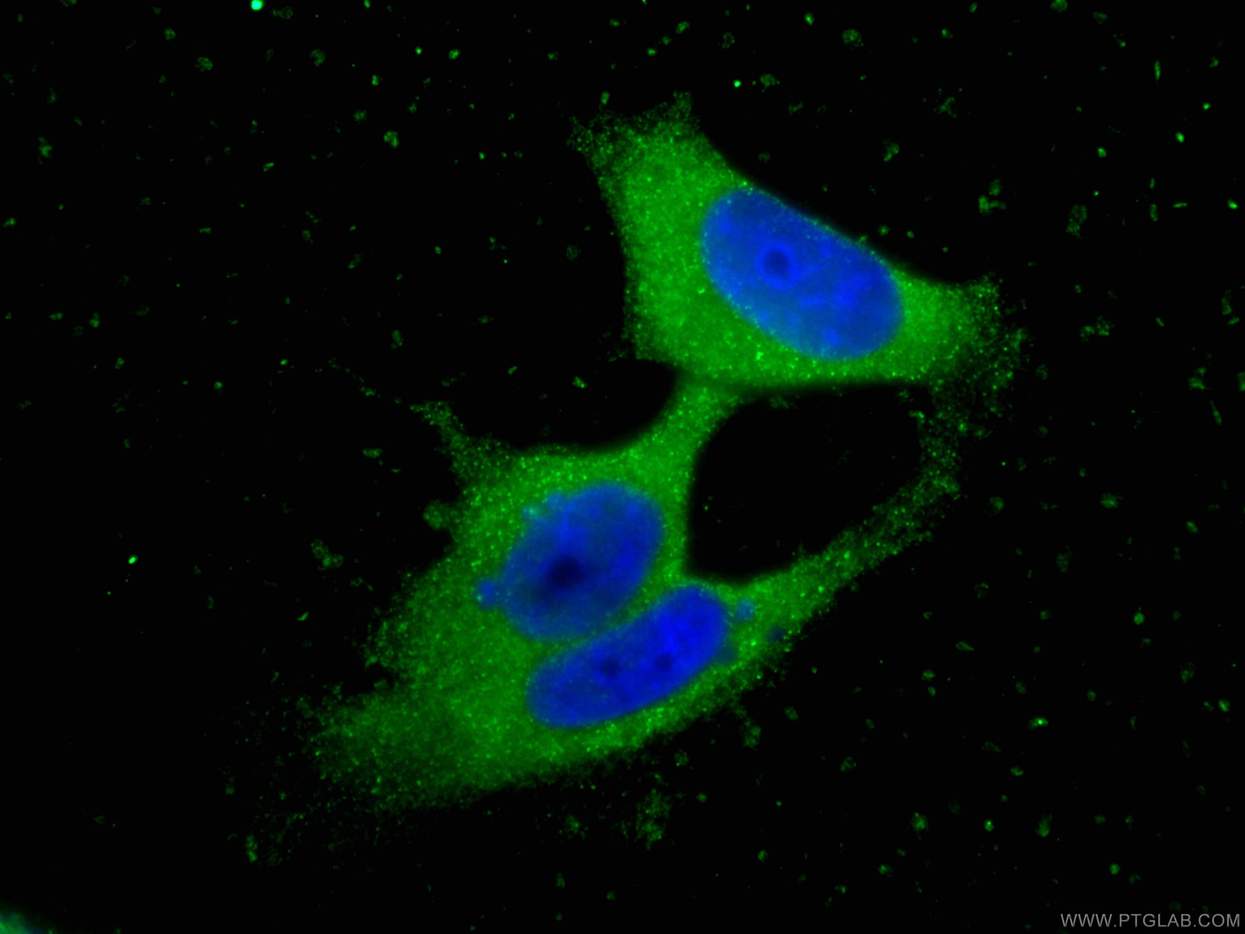 Immunofluorescence (IF) / fluorescent staining of MCF-7 cells using TIAR Monoclonal antibody (66907-1-Ig)