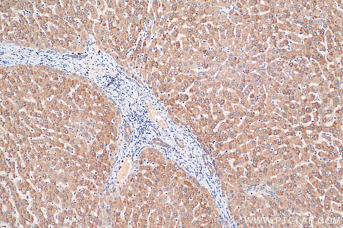 IHC staining of human liver using 23288-1-AP