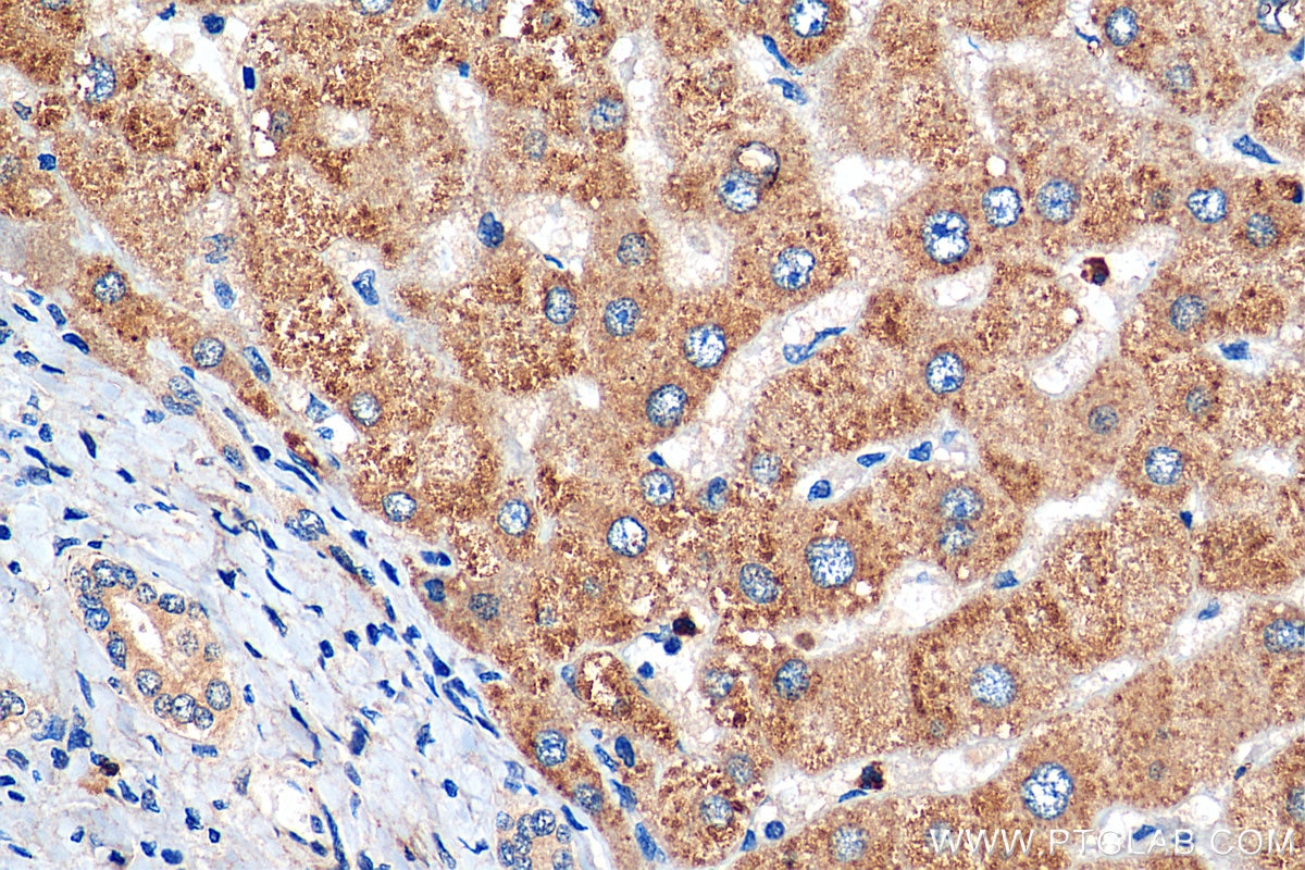 Immunohistochemistry (IHC) staining of human liver tissue using TRIF/TICAM1 Polyclonal antibody (23288-1-AP)