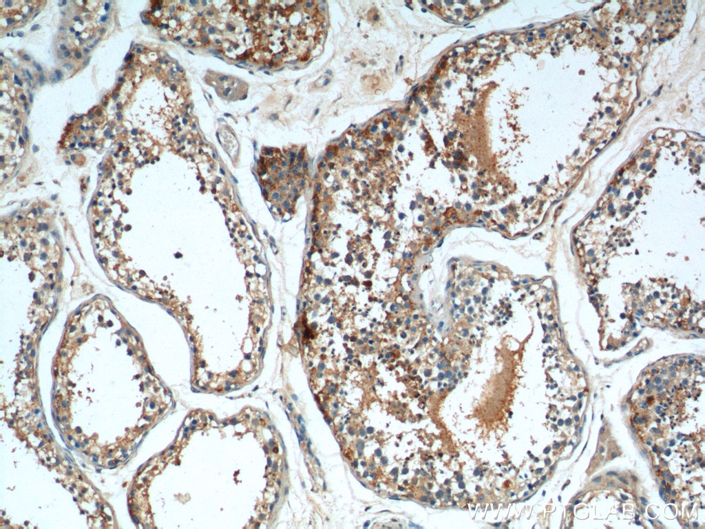 Immunohistochemistry (IHC) staining of human testis tissue using TRIF/TICAM1 Polyclonal antibody (23288-1-AP)