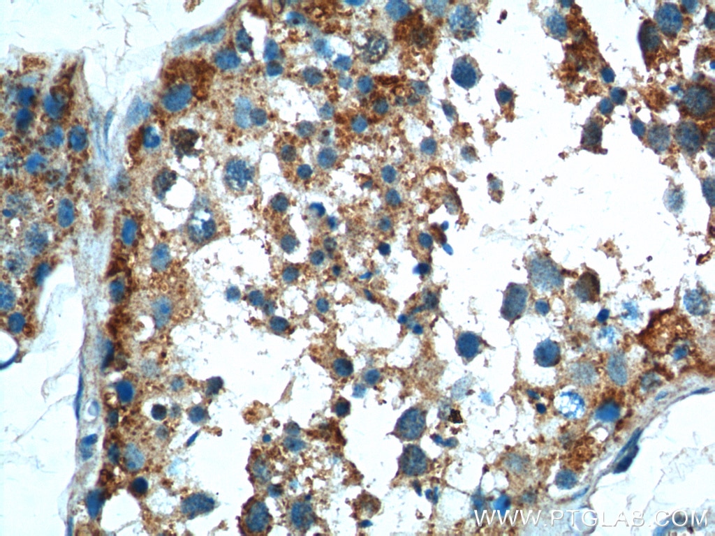 Immunohistochemistry (IHC) staining of human testis tissue using TRIF/TICAM1 Polyclonal antibody (23288-1-AP)
