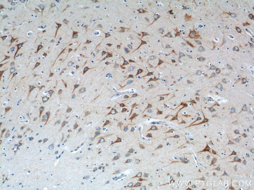 Immunohistochemistry (IHC) staining of human brain tissue using TRIF/TICAM1 Polyclonal antibody (23288-1-AP)