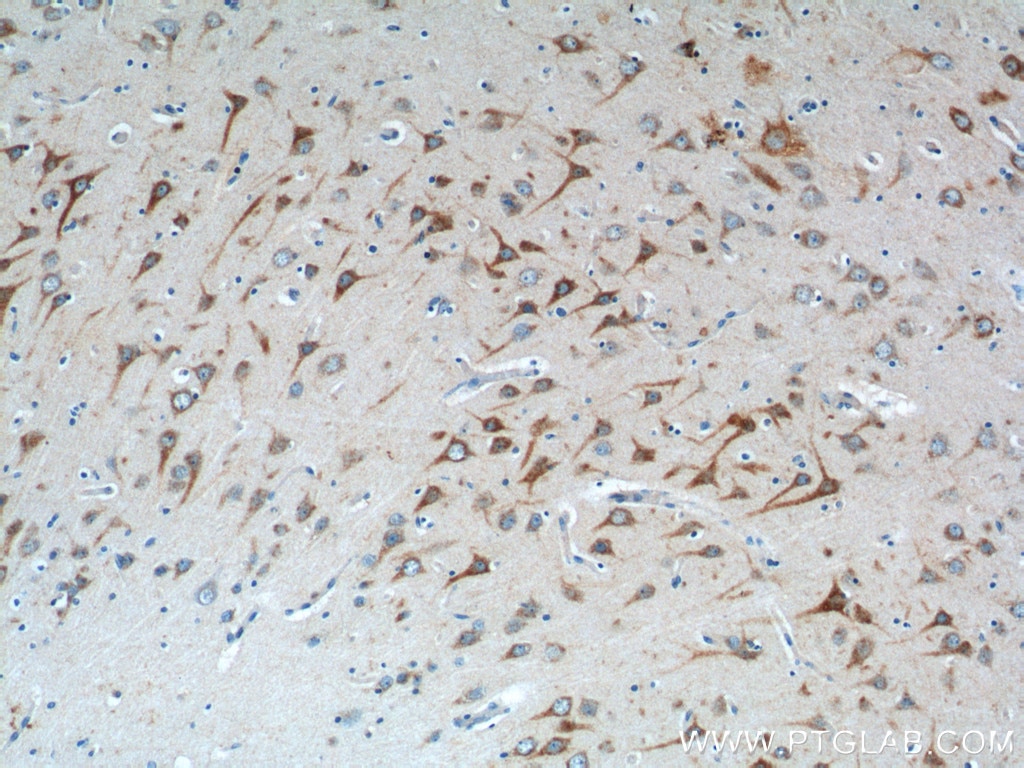 IHC staining of human brain using 23288-1-AP