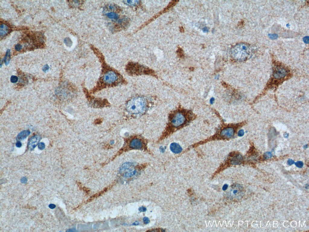 IHC staining of human brain using 23288-1-AP