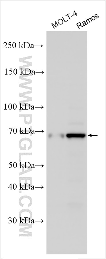 Western Blot (WB) analysis of various lysates using TRIF/TICAM1 Polyclonal antibody (23288-1-AP)