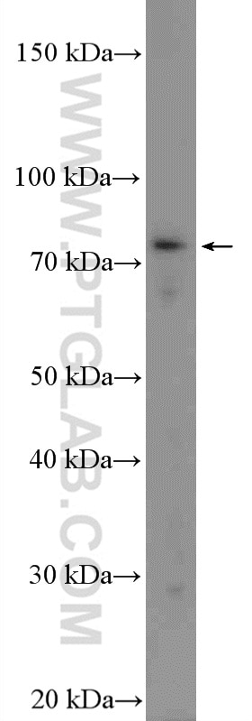 Western Blot (WB) analysis of Ramos cells using TRIF/TICAM1 Polyclonal antibody (23288-1-AP)