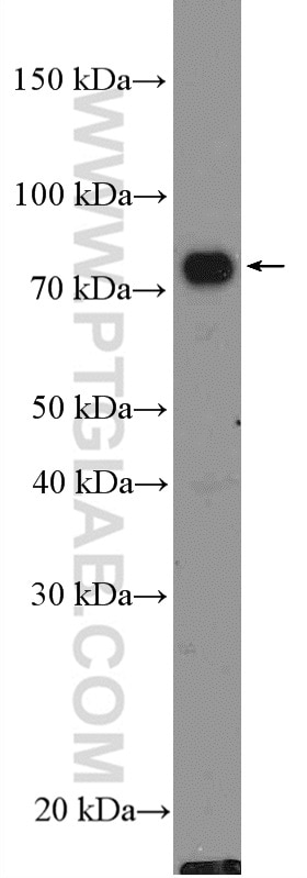 Western Blot (WB) analysis of Raji cells using TRIF/TICAM1 Polyclonal antibody (23288-1-AP)