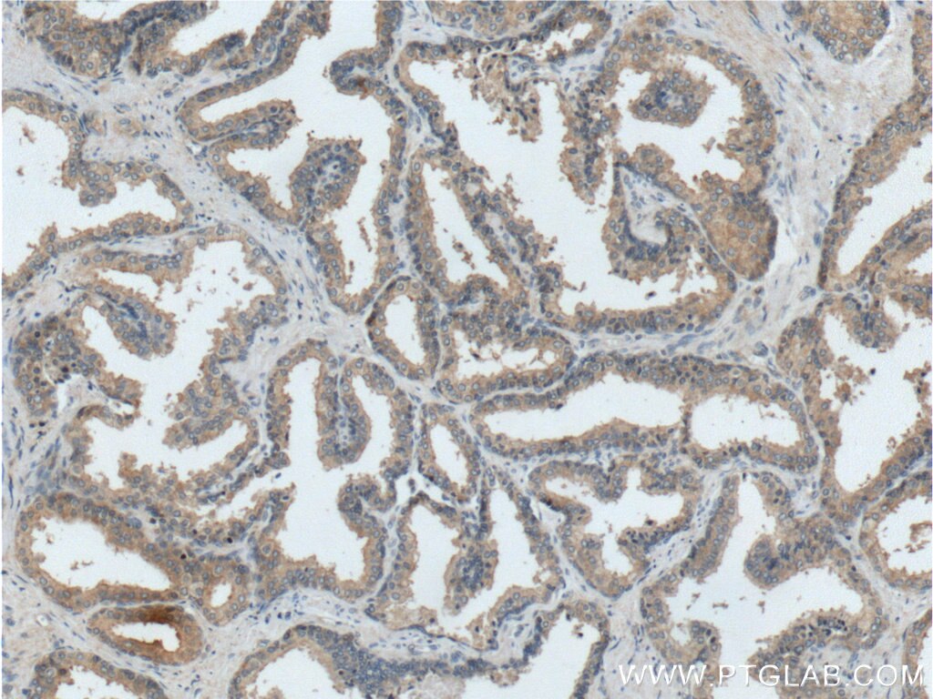 Immunohistochemistry (IHC) staining of human prostate hyperplasia tissue using TICAM2 Polyclonal antibody (19524-1-AP)