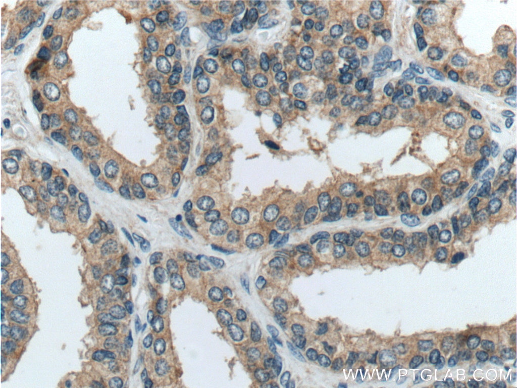 Immunohistochemistry (IHC) staining of human prostate hyperplasia tissue using TICAM2 Polyclonal antibody (19524-1-AP)