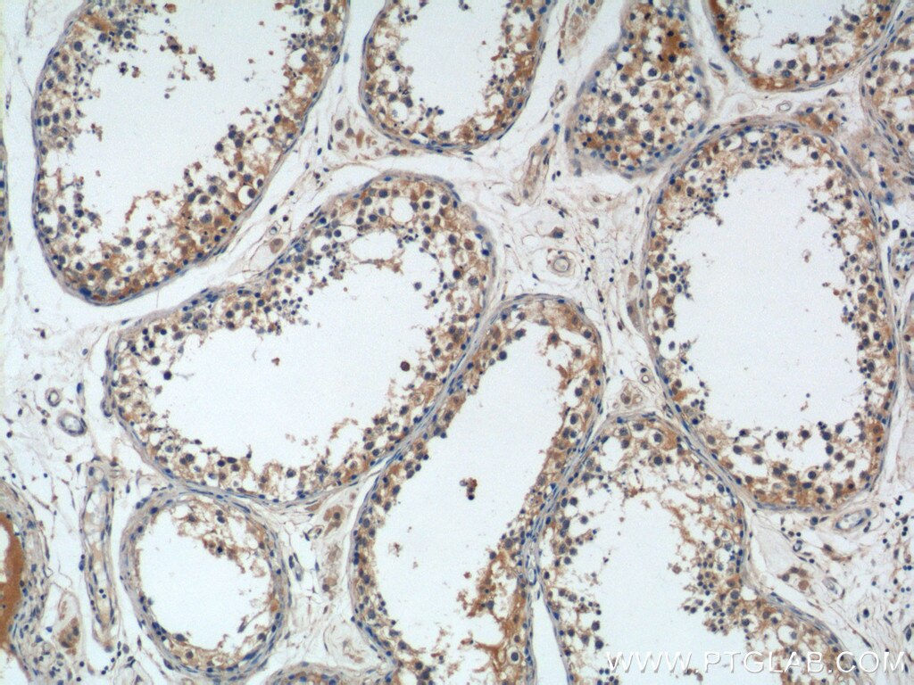Immunohistochemistry (IHC) staining of human testis tissue using TICAM2 Polyclonal antibody (19524-1-AP)