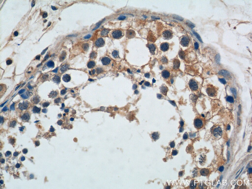 Immunohistochemistry (IHC) staining of human testis tissue using TICAM2 Polyclonal antibody (19524-1-AP)