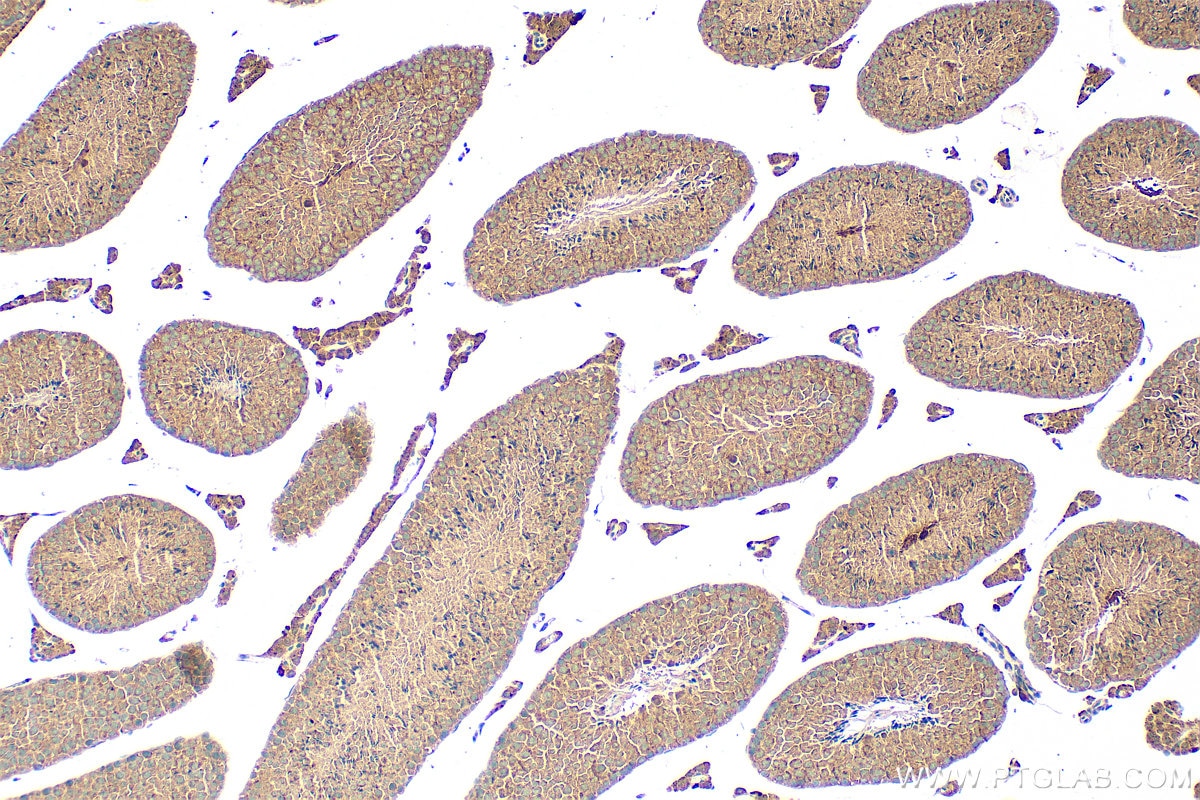 Immunohistochemistry (IHC) staining of mouse testis tissue using TICAM2 Polyclonal antibody (19524-1-AP)