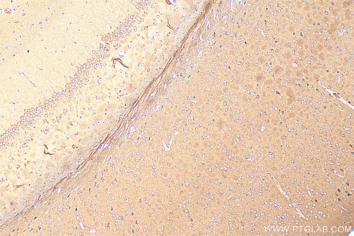 Immunohistochemistry (IHC) staining of mouse brain tissue using TICAM2 Polyclonal antibody (19524-1-AP)