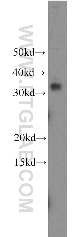 Western Blot (WB) analysis of HeLa cells using TICAM2 Polyclonal antibody (19524-1-AP)
