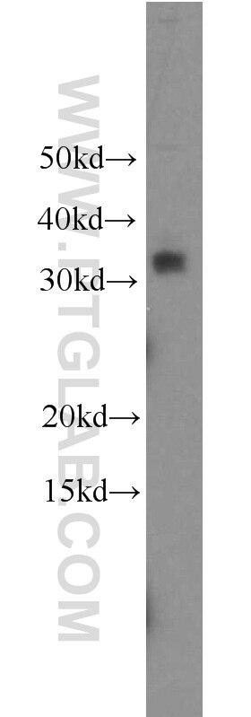 WB analysis of HeLa using 19524-1-AP