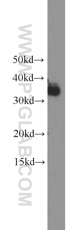 Western Blot (WB) analysis of human testis tissue using TICAM2 Polyclonal antibody (19524-1-AP)