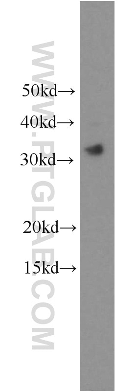 Western Blot (WB) analysis of PC-3 cells using TICAM2 Polyclonal antibody (19524-1-AP)