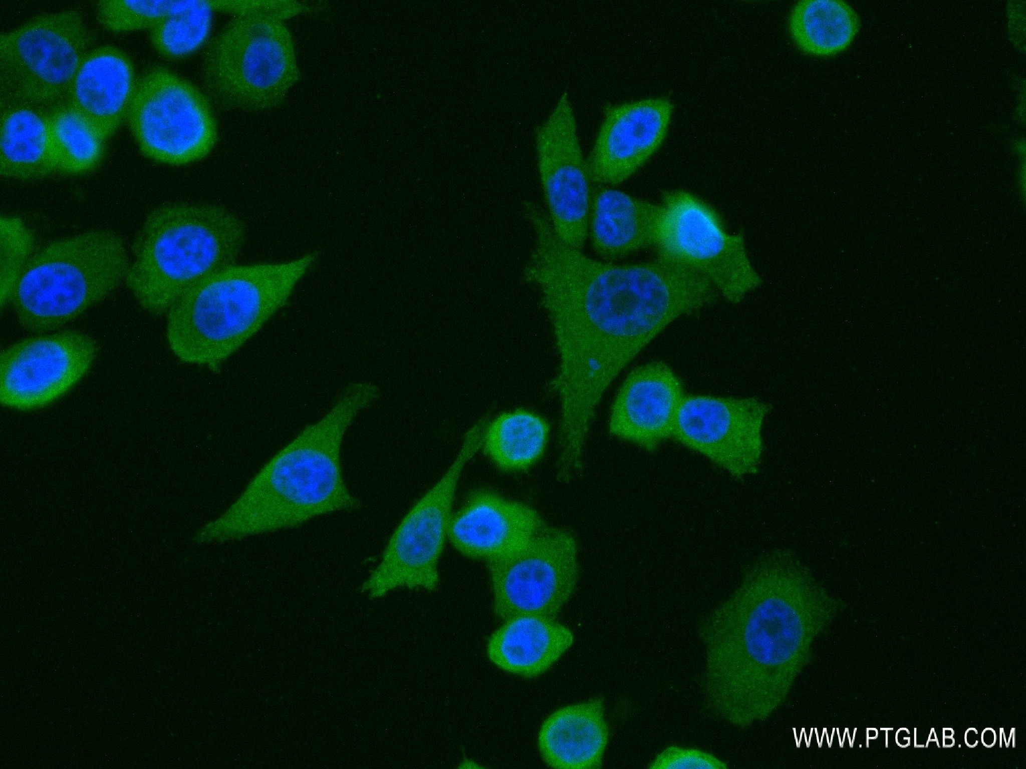 Immunofluorescence (IF) / fluorescent staining of PC-3 cells using TICAM2 Recombinant antibody (84064-6-RR)