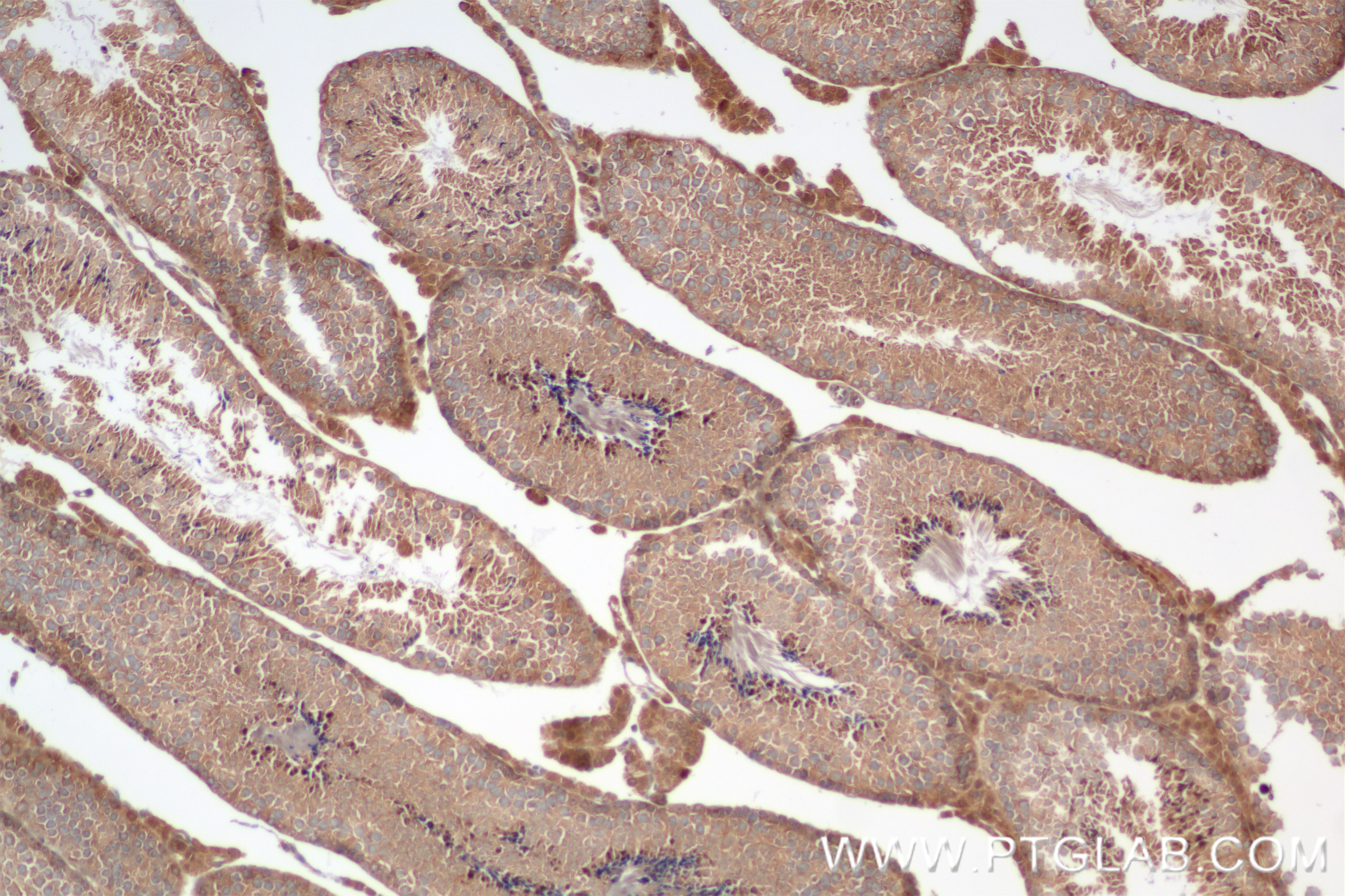 Immunohistochemistry (IHC) staining of mouse testis tissue using TICAM2 Recombinant antibody (84064-6-RR)