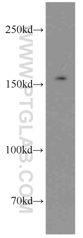 Western Blot (WB) analysis of MCF-7 cells using Tie1 Polyclonal antibody (19329-1-AP)