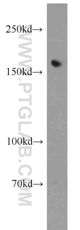 Western Blot (WB) analysis of K-562 cells using Tie1 Polyclonal antibody (19329-1-AP)