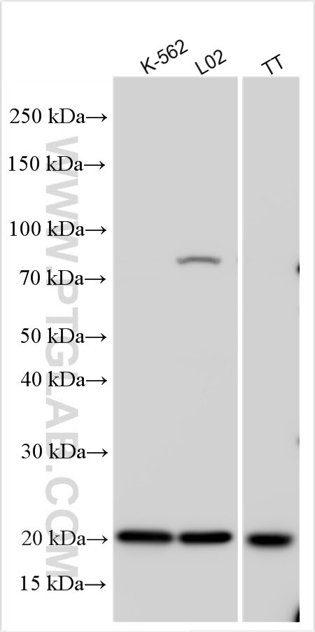 Western Blot (WB) analysis of various lysates using TIFA Polyclonal antibody (11333-1-AP)