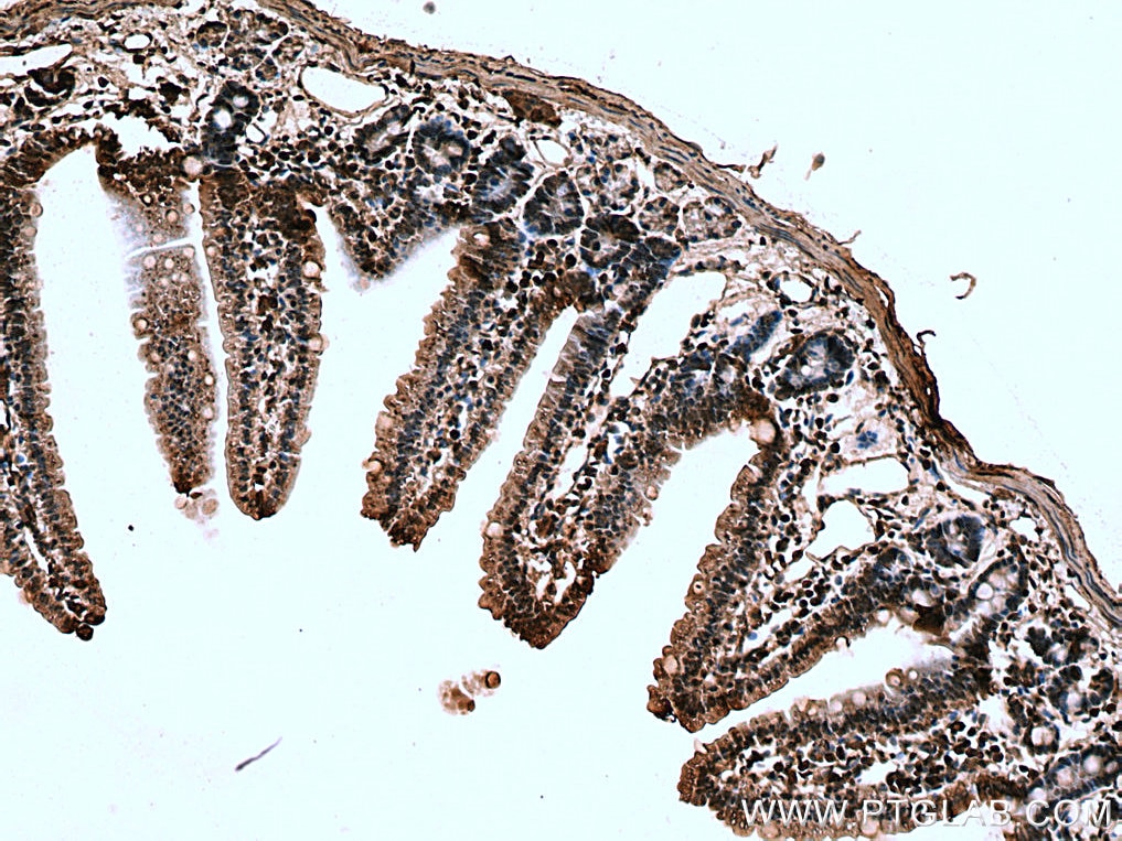 Immunohistochemistry (IHC) staining of mouse small intestine tissue using TIGAR Polyclonal antibody (22136-1-AP)