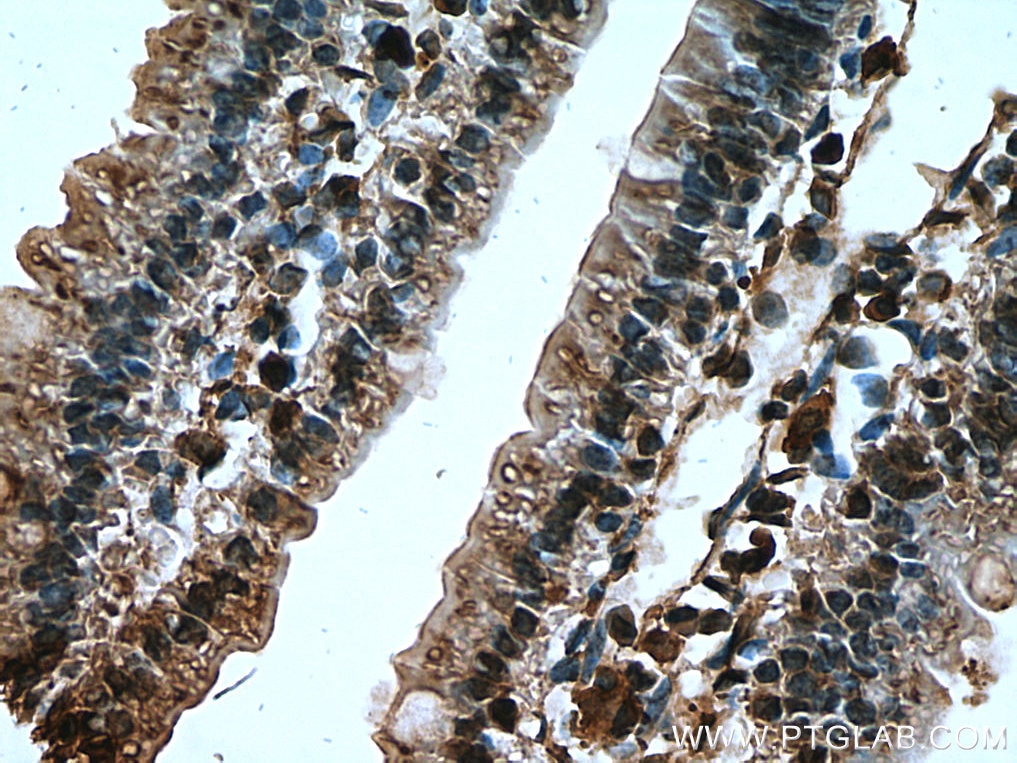 Immunohistochemistry (IHC) staining of mouse small intestine tissue using TIGAR Polyclonal antibody (22136-1-AP)