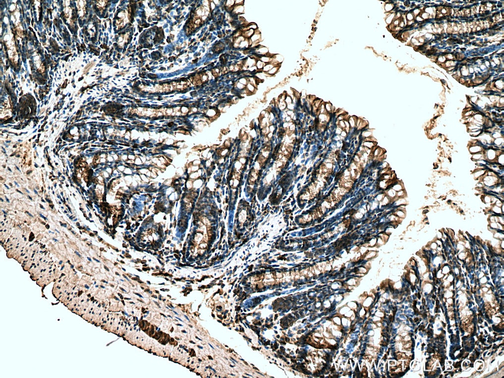 Immunohistochemistry (IHC) staining of mouse colon tissue using TIGAR Polyclonal antibody (22136-1-AP)