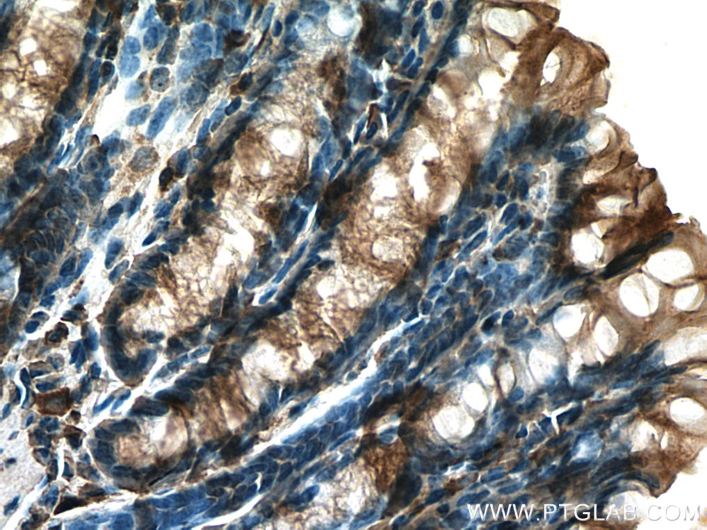Immunohistochemistry (IHC) staining of mouse colon tissue using TIGAR Polyclonal antibody (22136-1-AP)