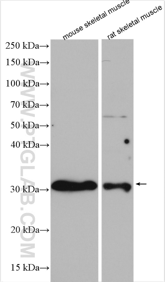 Western Blot (WB) analysis of various lysates using TIGAR Polyclonal antibody (22136-1-AP)